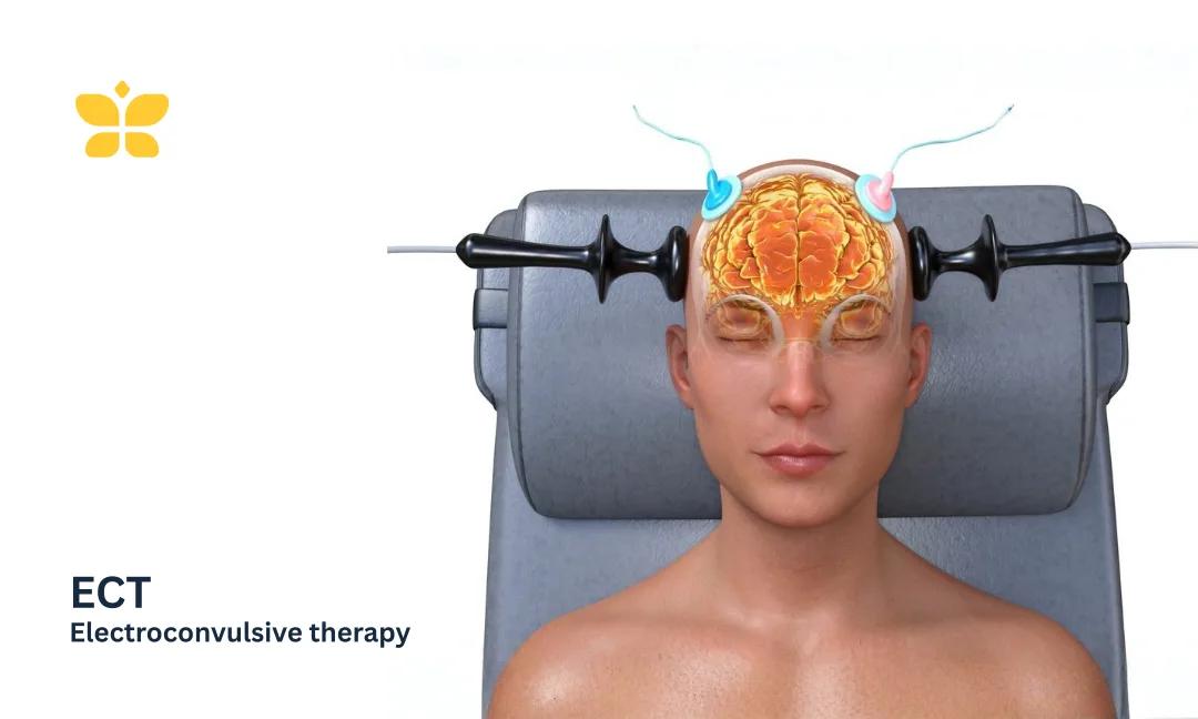 ECT Treatment