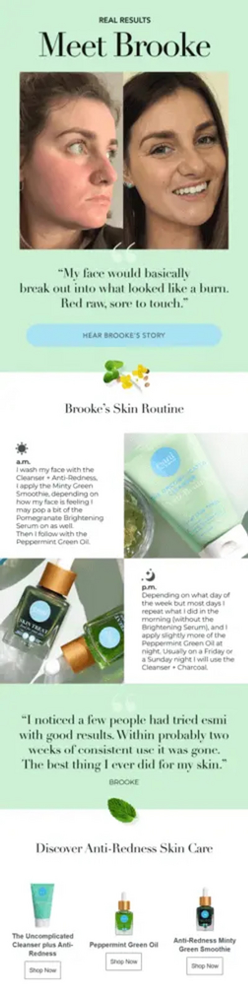Image shows an email with a hero image of a person’s face before their skincare routine (their face is red) and after their skincare routine (they’re smiling with a clear view of their freckles). Following are several panels of description of their skincare routine, with several product images such as a small tube of cleaners, two small bottles of green serum, and a dark blue bottle of serum.