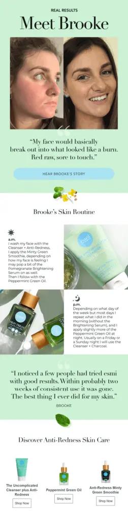 Image shows an email with a hero image of a person’s face before their skincare routine (their face is red) and after their skincare routine (they’re smiling with a clear view of their freckles). Following are several panels of description of their skincare routine, with several product images such as a small tube of cleaners, two small bottles of green serum, and a dark blue bottle of serum.