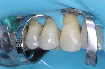 BIOIMPLANTES | Dentista / Clínica Odontológica no Bessa, João Pessoa - PB