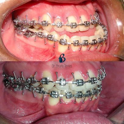 Dr. Bruno Torres - Cirurgia Ortognática & Implantes dentários em Aracaju