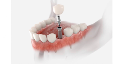 Cristal Odontológica | Dentista em João Pessoa