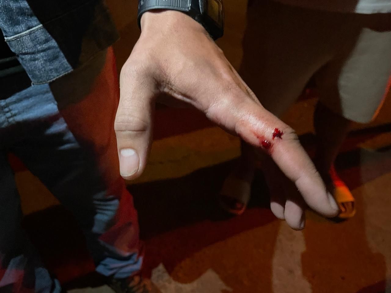 Policiais e SAMU atendem jovem autista em crise em Três Lagoas.