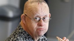 mennesker med udviklingshæmning og demens