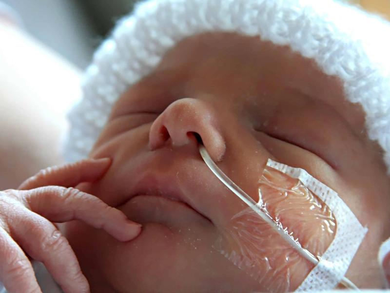 Understanding tube feeding: a guide to necessity, safety, and care