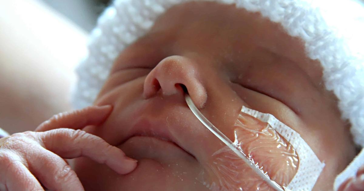 Understanding tube feeding: a guide to necessity, safety, and care