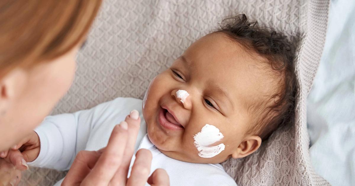 Baby skin survival guide: preventing diaper rash, eczema, and irritation
