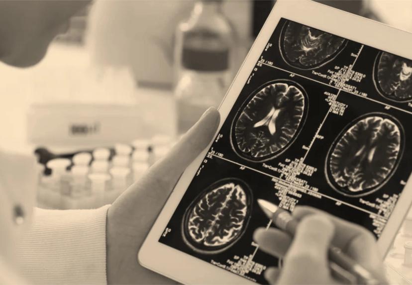 a tablet computer displaying brain scans