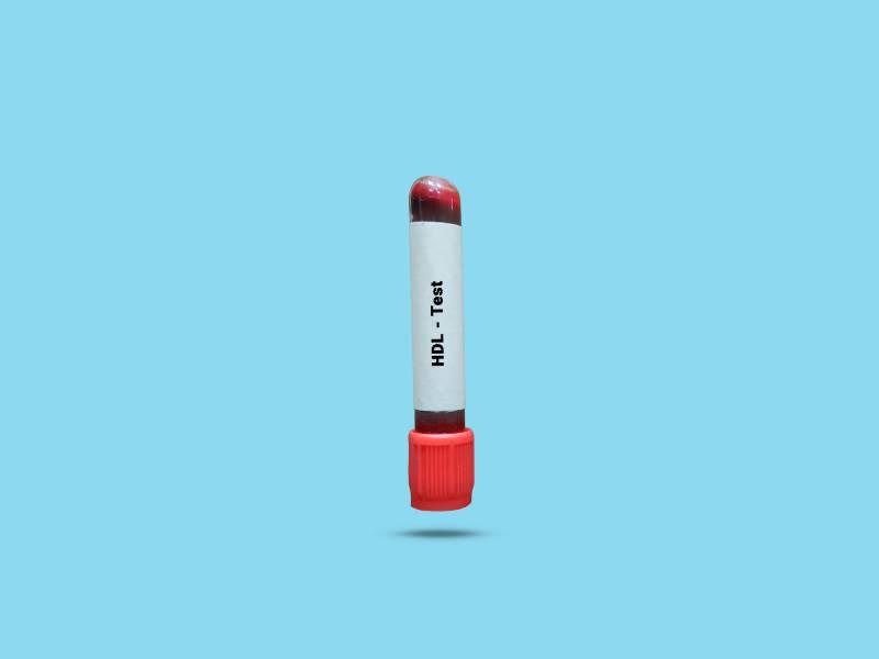 cause-cholesterol-hdl-trop-bas