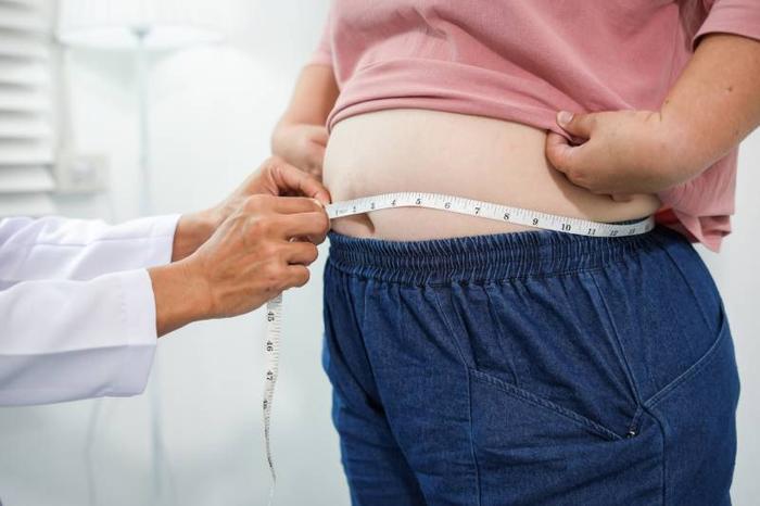 obesite-abdominale