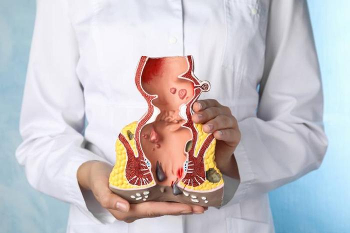 rectum