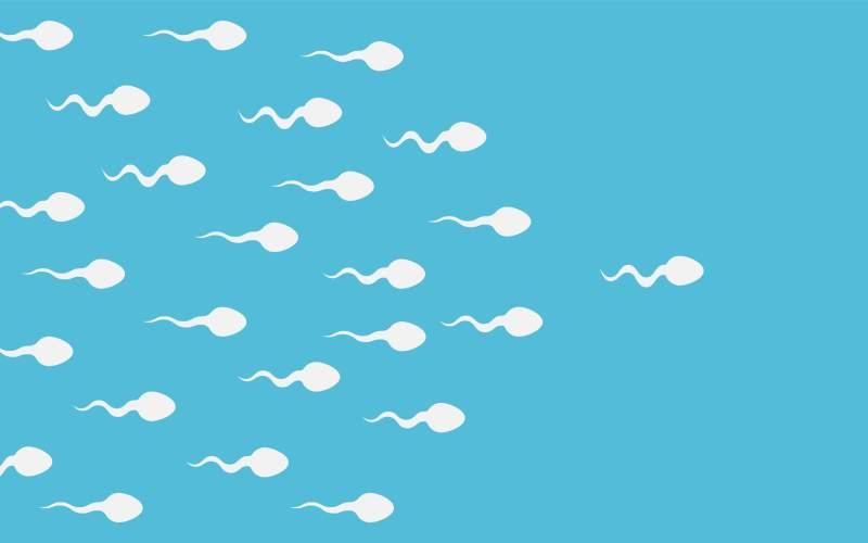 varicocele-infertilite