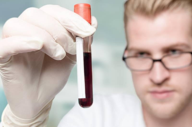 quest-ce-que-le-cholesterol-ldl