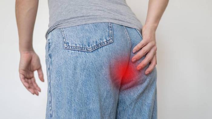irritation-anus