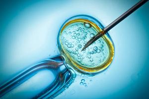 fecondation-in-vitro