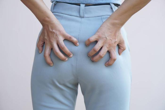 anus-qui-gratte