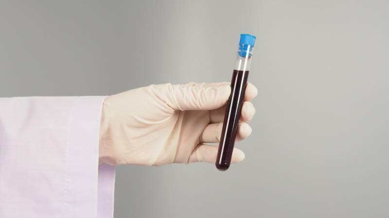 cholesterol-hdl-bas-symptomes