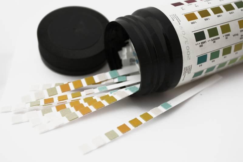 test-urinaire-laboratoire