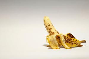 herpes-genital-symptome