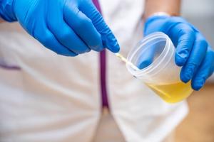 urine-foncee