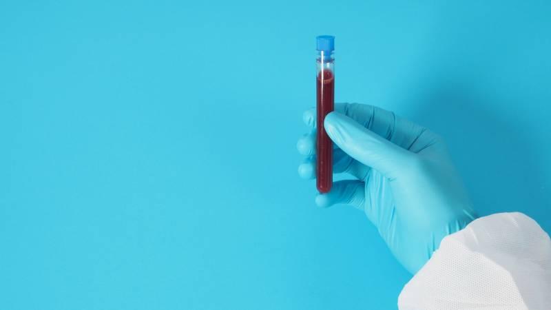 taux-de-cholesterol-normal-a-60-ans