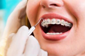 orthodontie