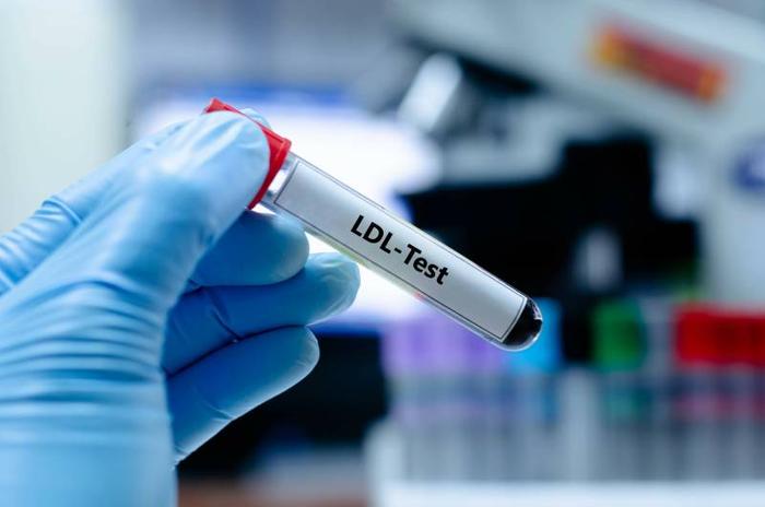 ldl-cholesterol-norme