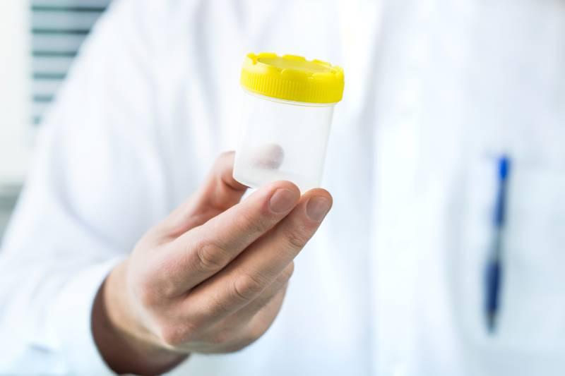 test-urinaire-drogue