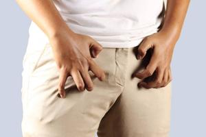 intertrigo-inguinal