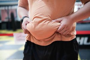 Chirurgie réparatrice après perte de poids : délais, risques et prise en charge