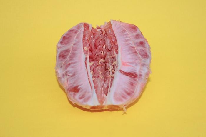 mycose-vaginale