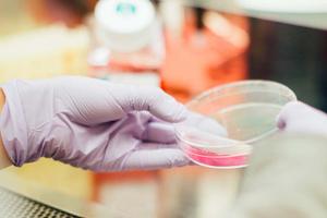 test-spermogramme