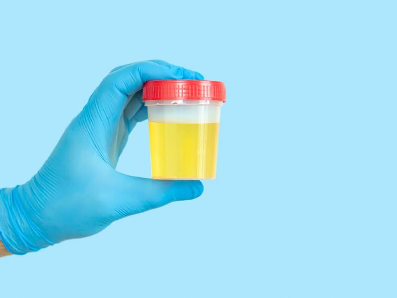 test-infection-urinaire