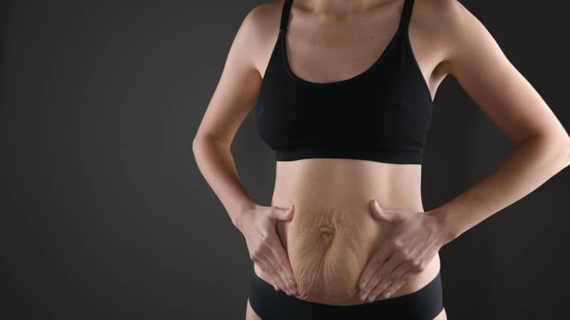 retendre-la-peau-du-ventre-sans-chirurgie