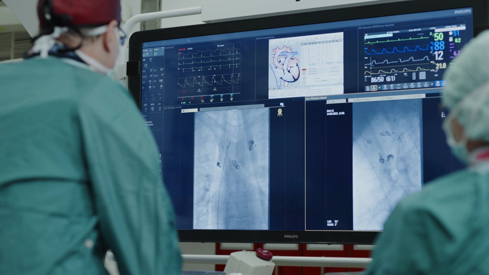 Imagefilm HDZ Framegrabs