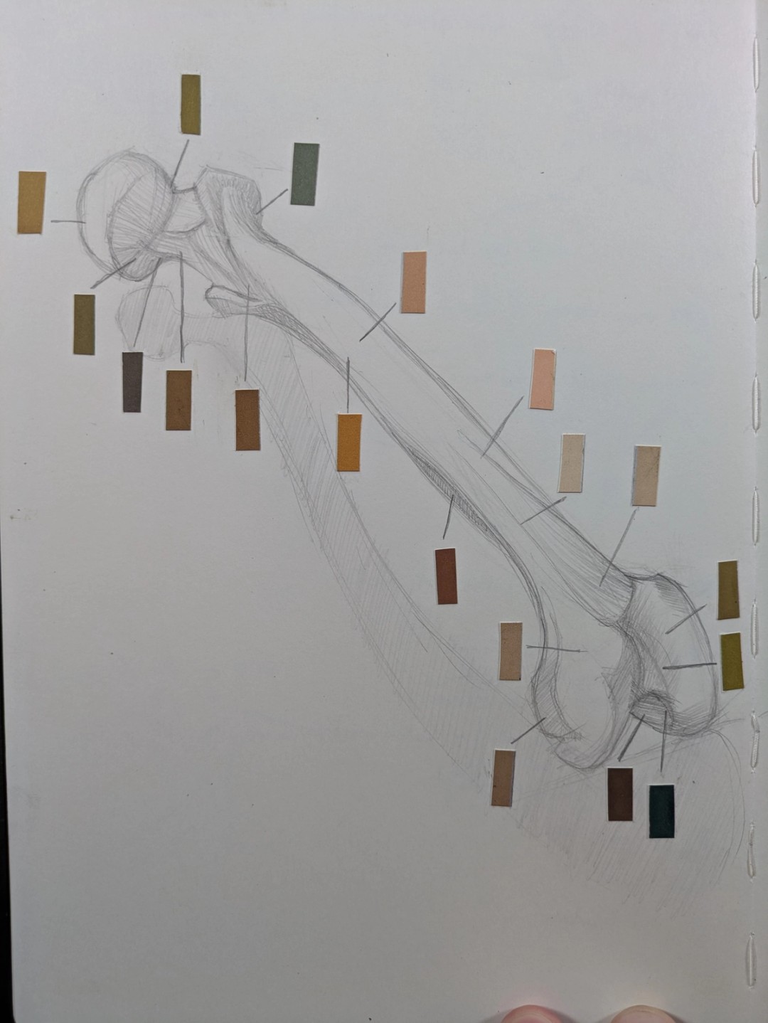 A sketch of a femur bone with colored labels.