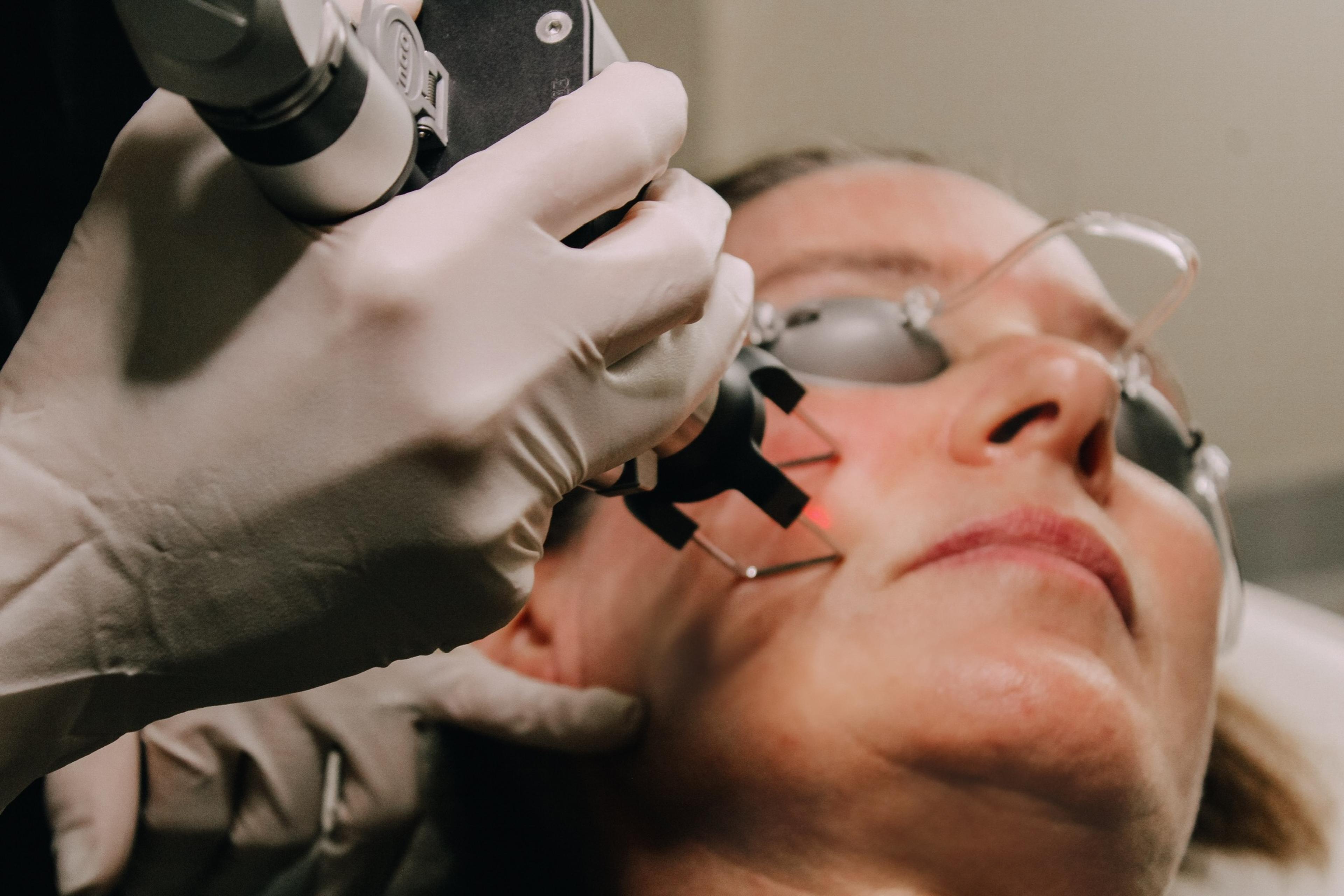 A laser treatment in progress at RENU Medical Aesthetics