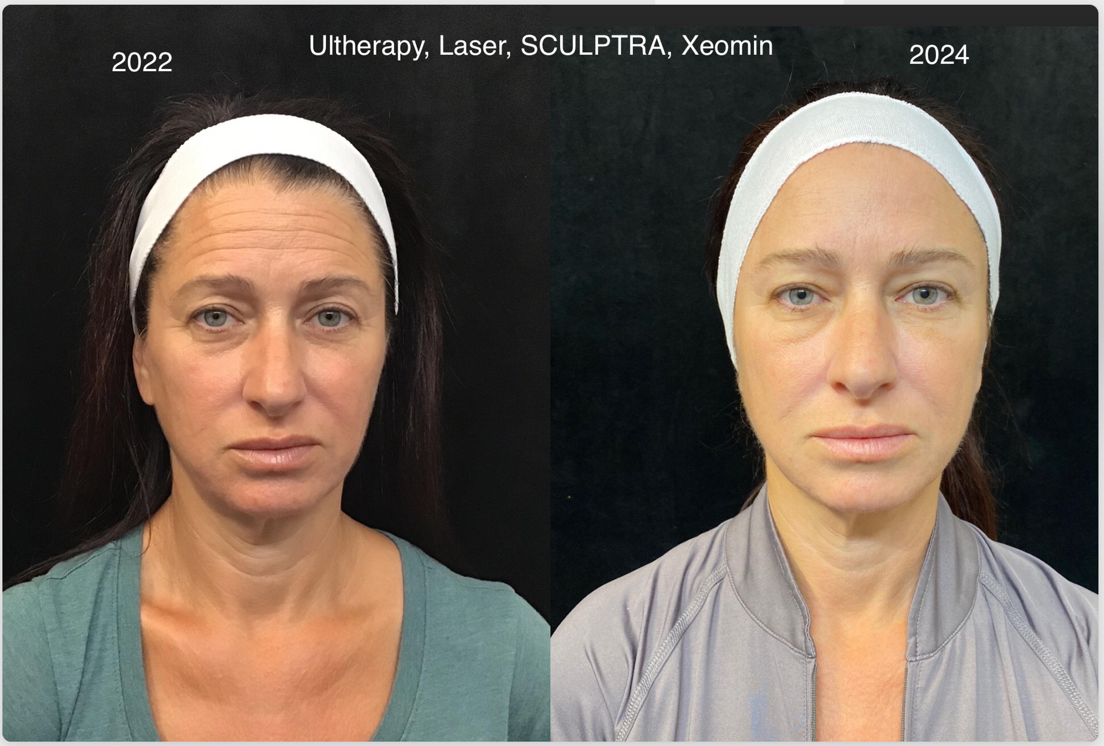Patient before and after (2022-2024)