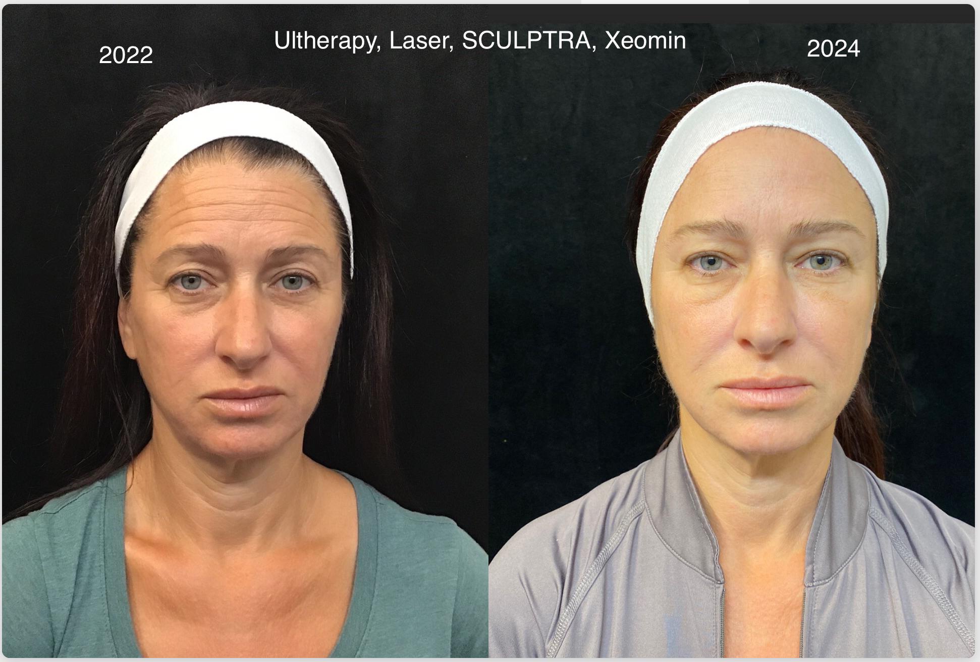 Patient before and after (2022-2024)