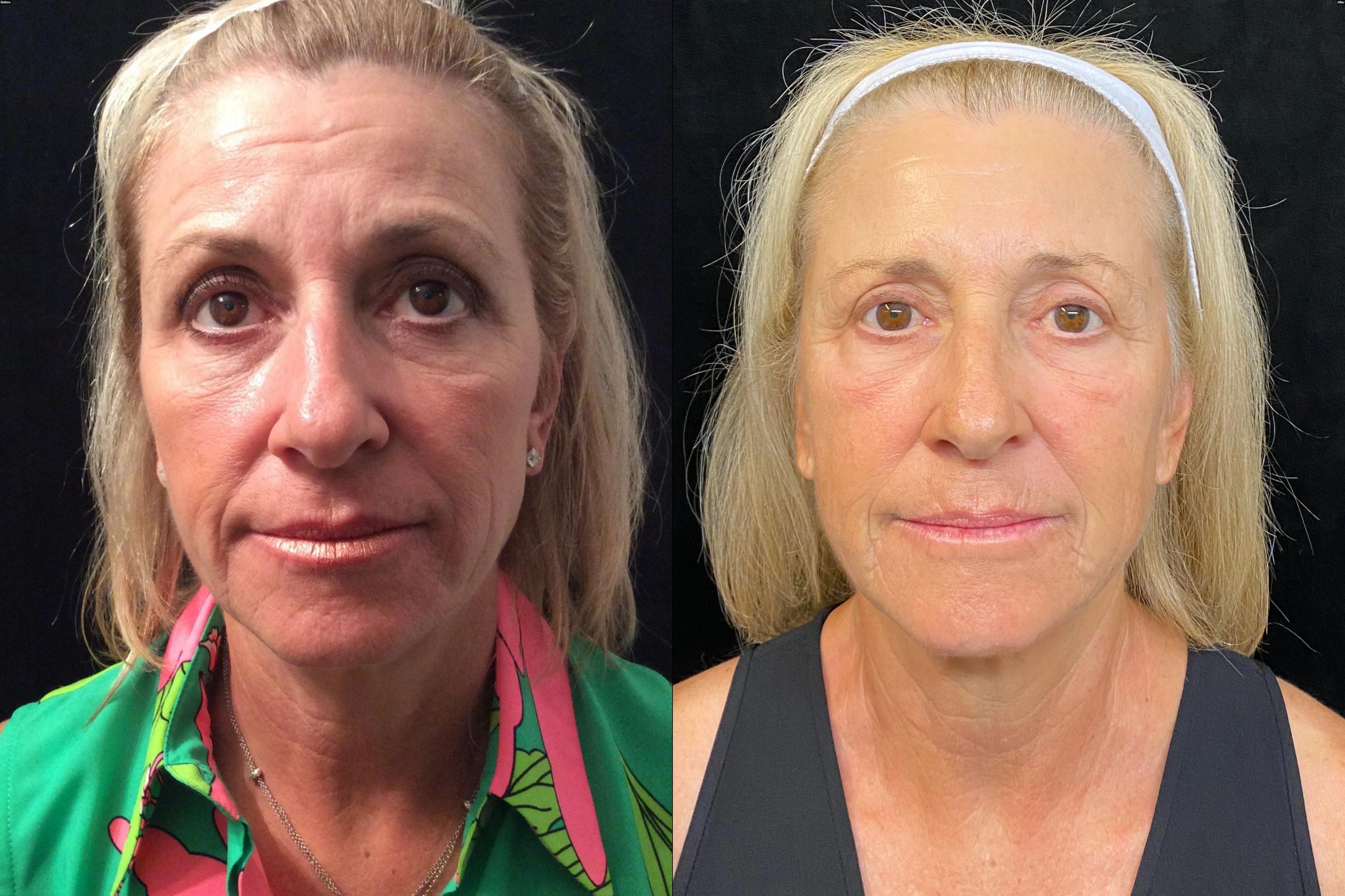 Patient before and after (2017-2026)