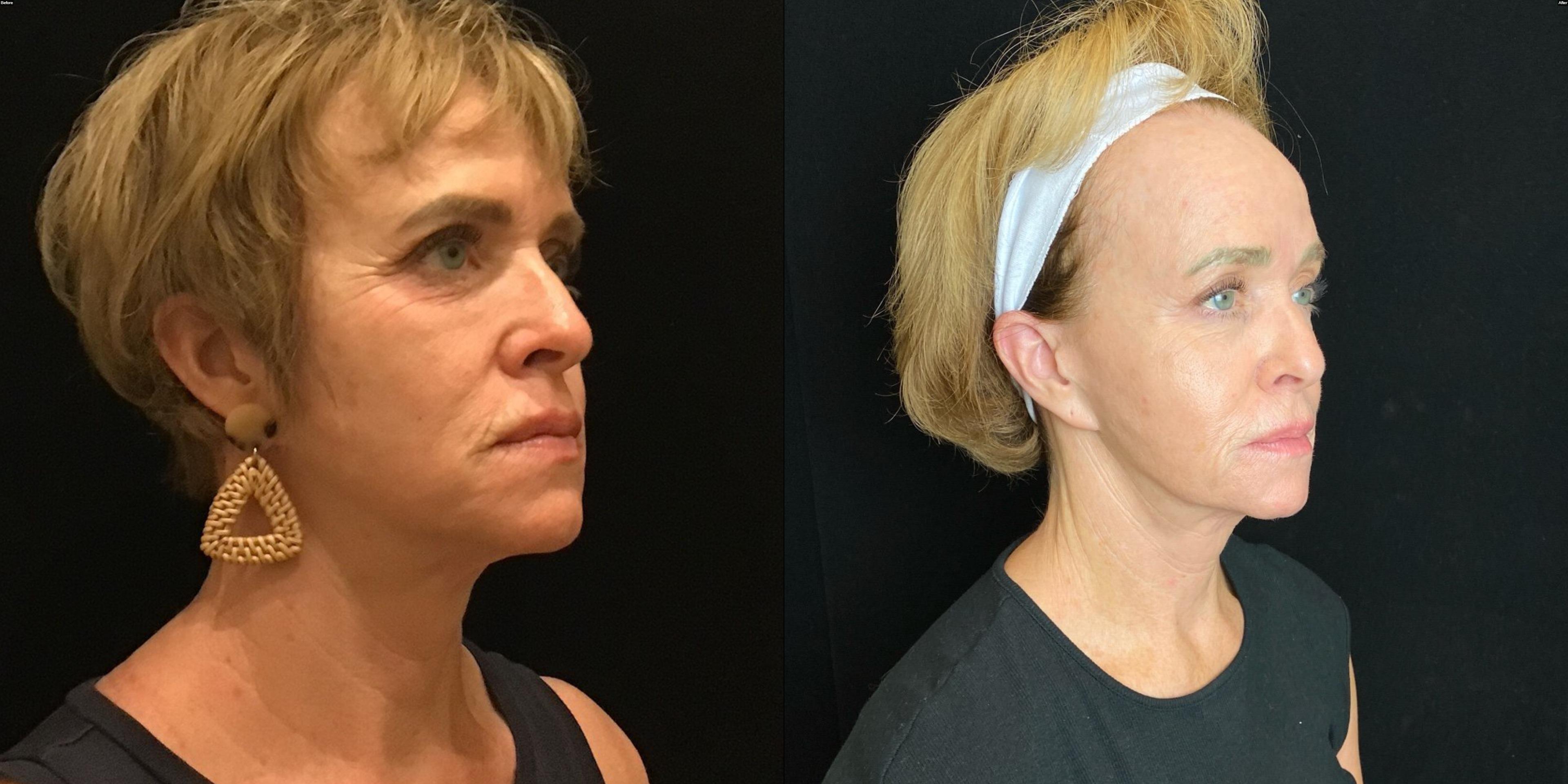 Patient before and after (2019-2026)