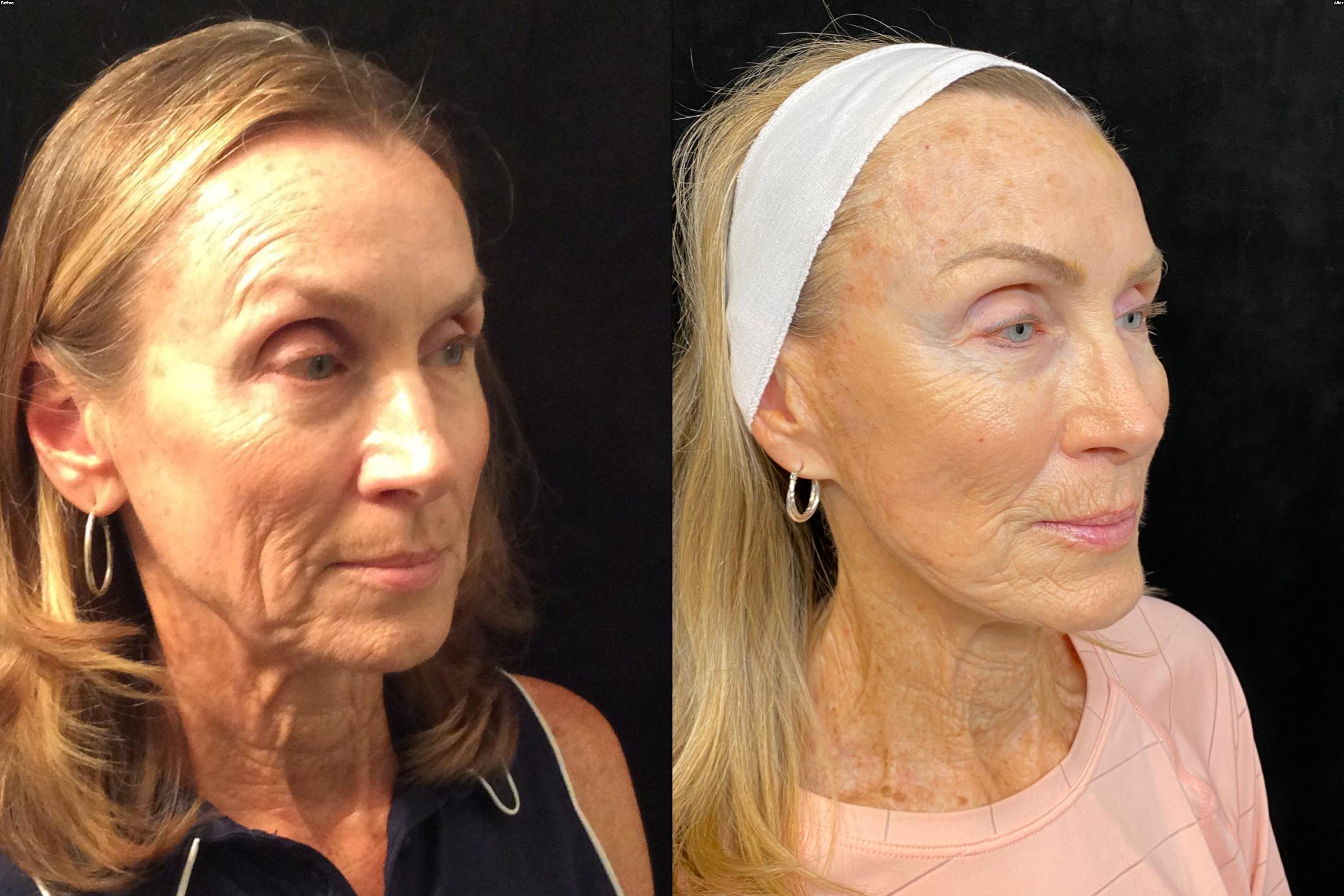 Patient before and after (2017-2026)