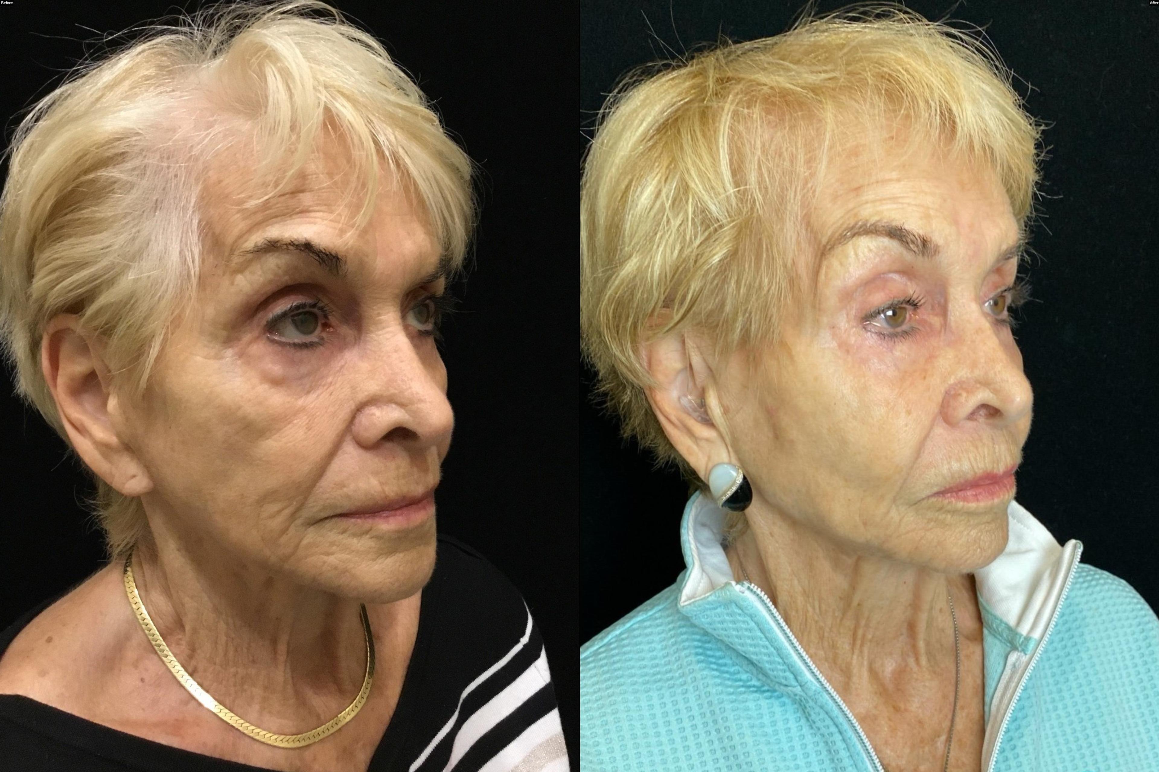 Patient before and after (2016-2026)