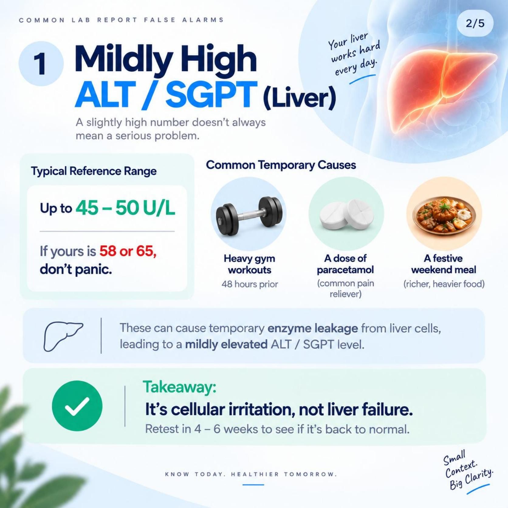 Common lab report false alarm: mildly high ALT/SGPT liver enzyme, showing typical temporary causes like heavy workouts, painkillers, and a heavy meal