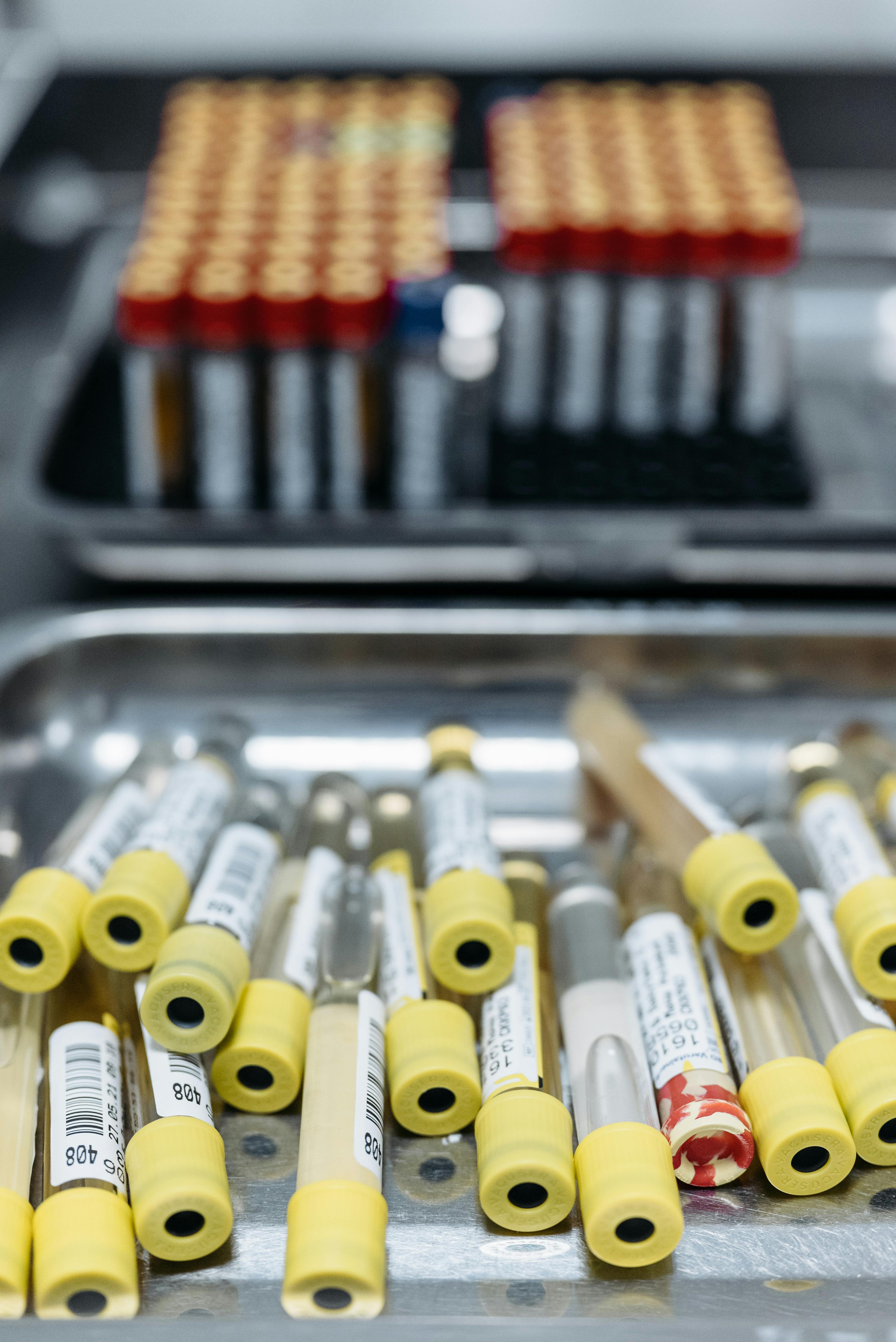 How to Make Your LIMS Work For You
