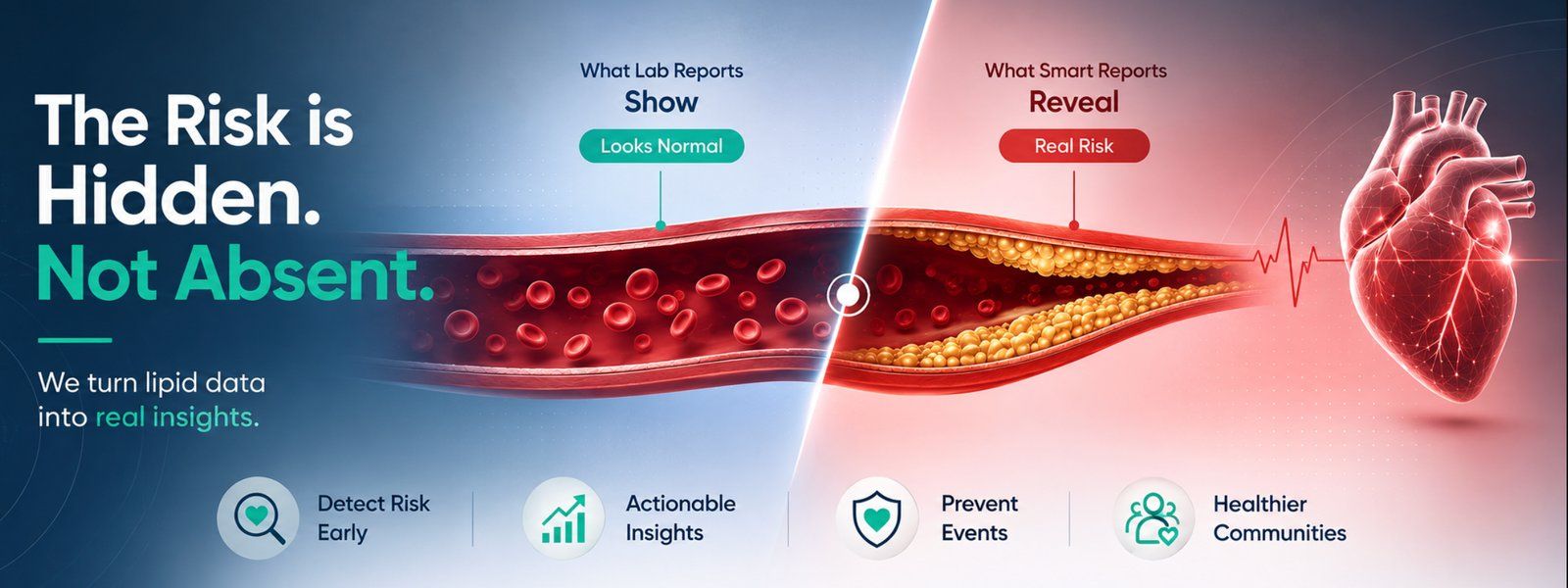 Comparison of a clear artery labelled 'what lab reports show' against a plaque-narrowed artery labelled 'what Smart Reports reveal', beside a human heart