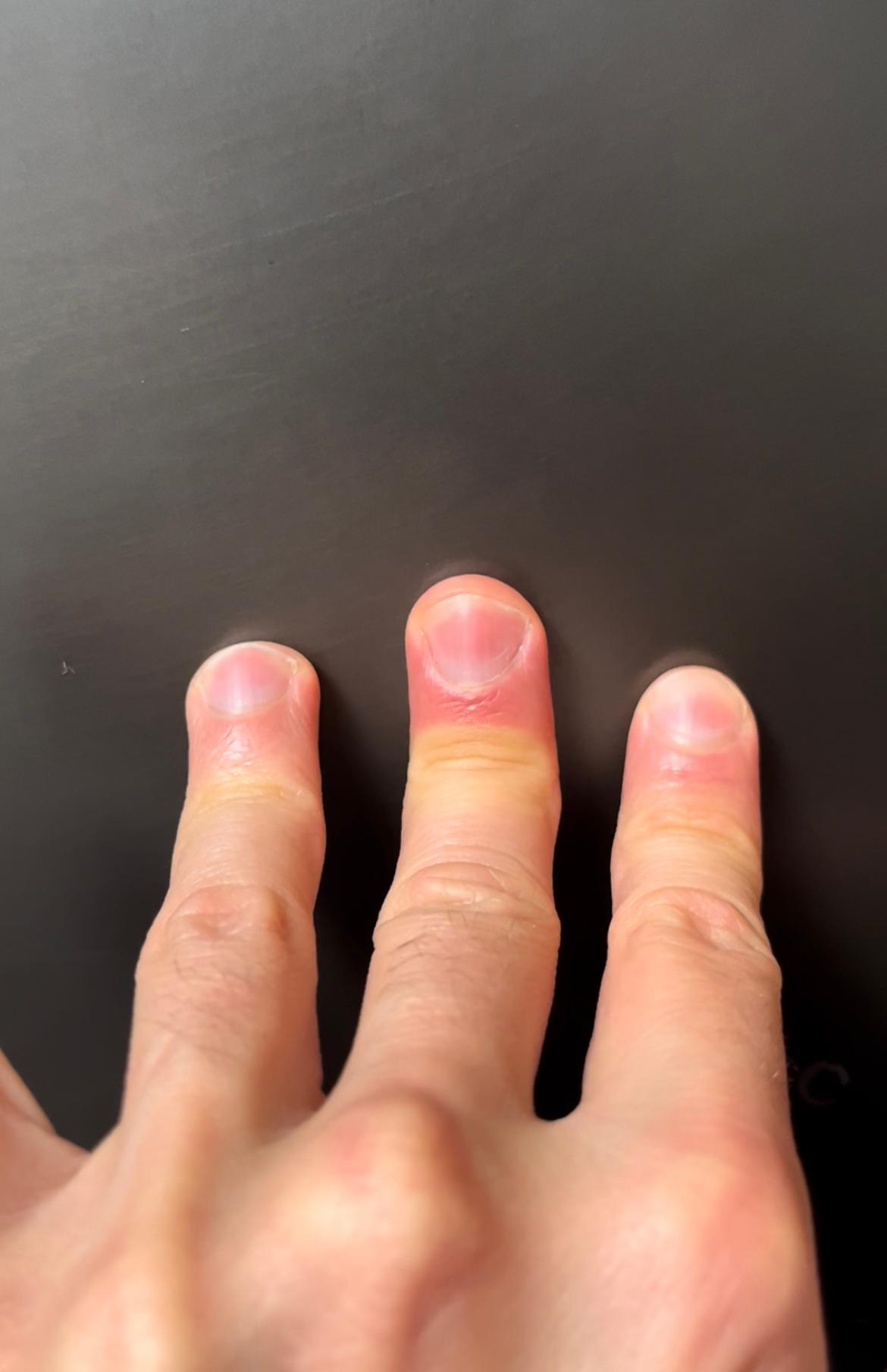 Close-up photo of three fingers pressed against a gray surface.