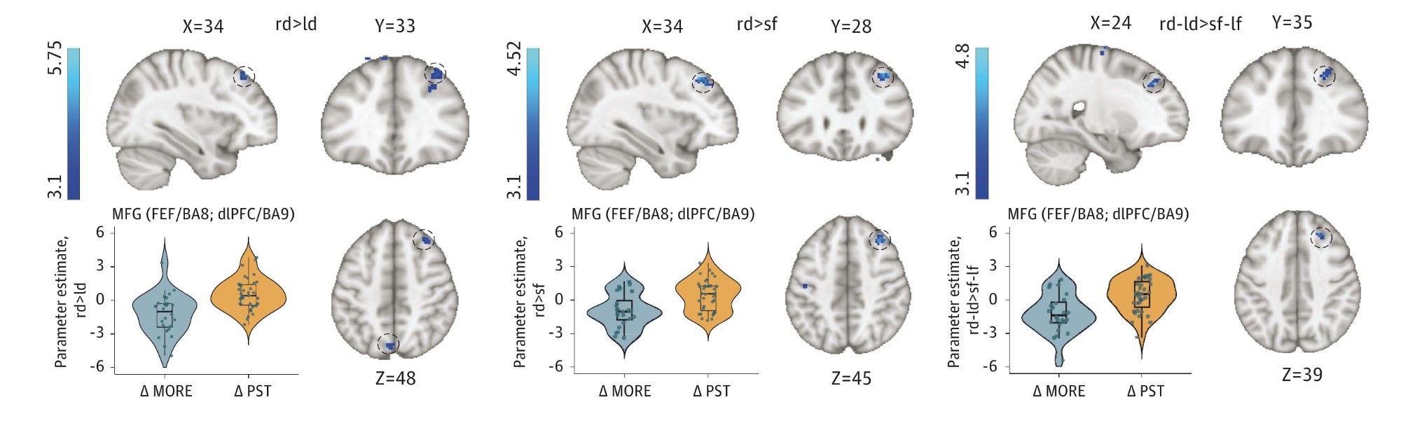 A trial links mindfulness-based therapy to changes in responses to opioid cues.