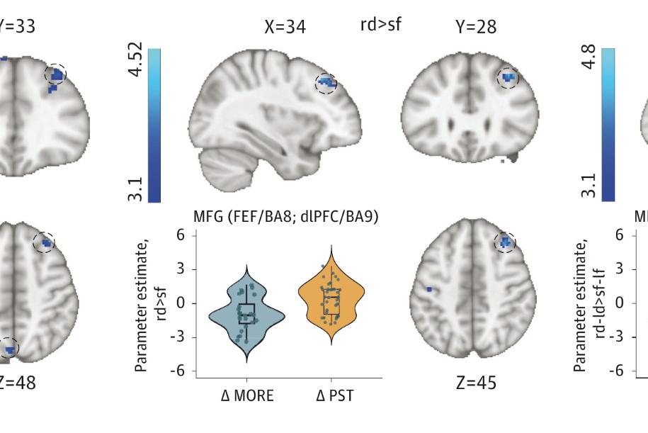 A trial links mindfulness-based therapy to changes in responses to opioid cues.