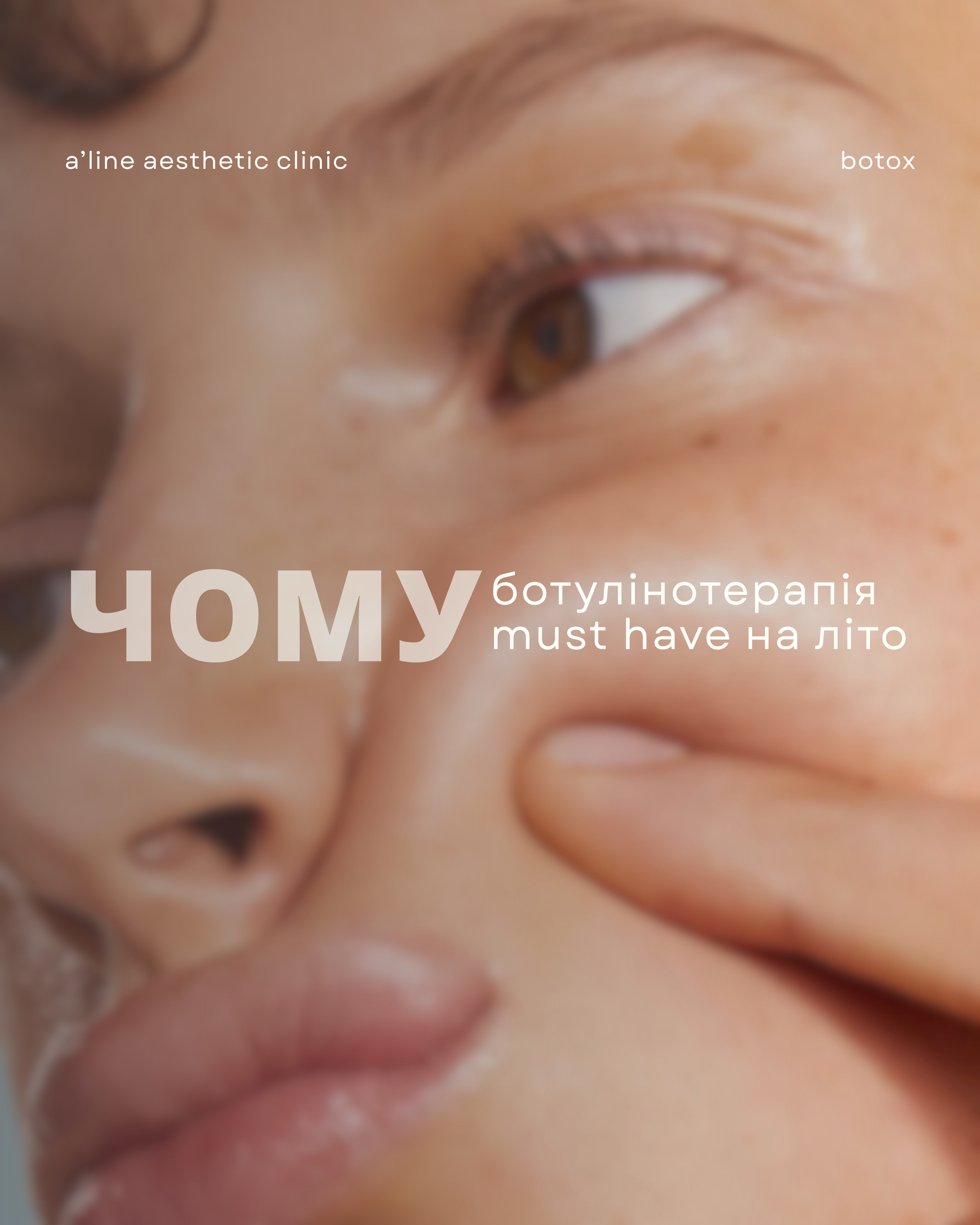 Чому ботулінотерапія must have на літо?
